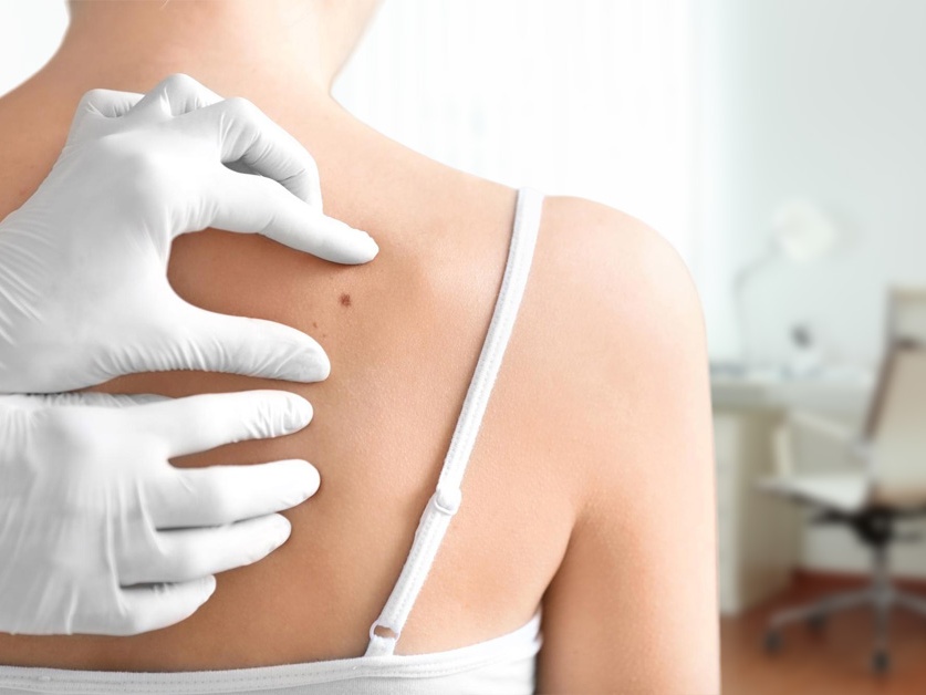 Kožní ambulance - MUDr. Svatava Vaďurová