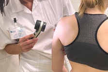 Nemocnice Kyjov odhalila během preventivní akce čtyři melanomy. Kontroly znamének přilákaly stovky lidí